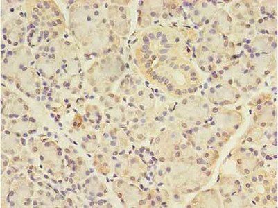 ANGPTL7 Antibody