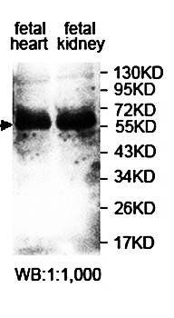 ANKDD1A Rabbit Polyclonal Antibody