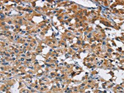 ANKHD1 Antibody