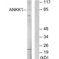 ANKK1 antibody