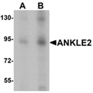 ANKLE2 Antibody