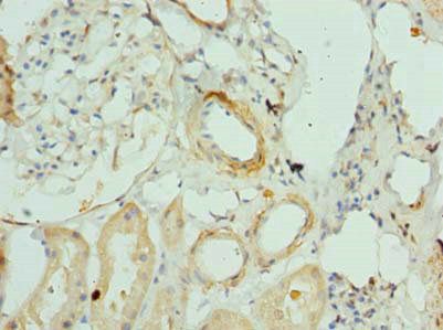 ANKMY1 Antibody