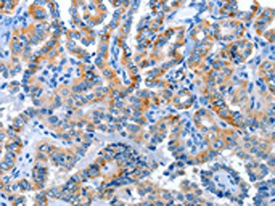 ANKMY1 Antibody