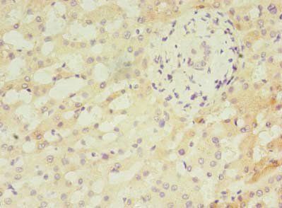 ANKMY2 Antibody