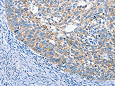 ANKMY2 Antibody