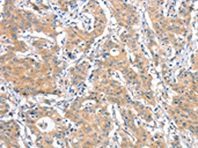 ANKMY2 Antibody