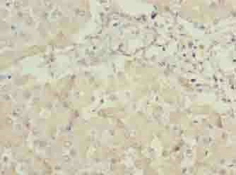 ANKRA2 Antibody