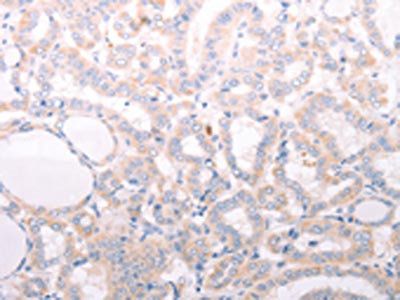 ANKRA2 antibody