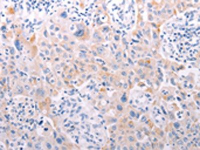 ANKRA2 antibody