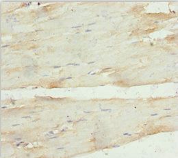 ANKRD1 Antibody