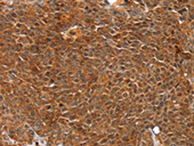 ANKRD1 Antibody