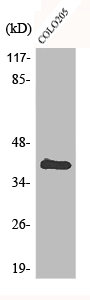 ANKRD1 Antibody