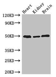 ANKRD10 antibody