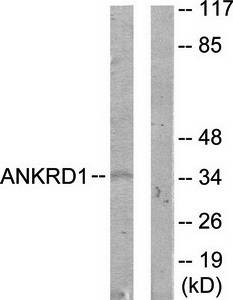 ANKRD1 antibody