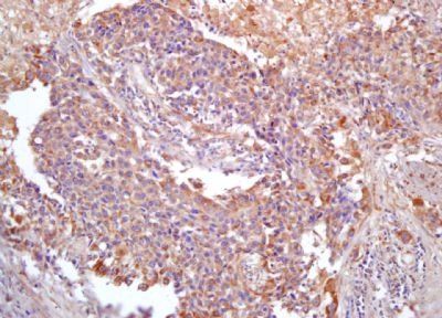 ANKRD1 Rabbit Polyclonal Antibody