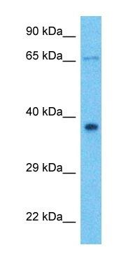 ANKRD2 antibody