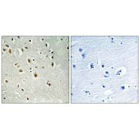ANKRD20A3 Antibody