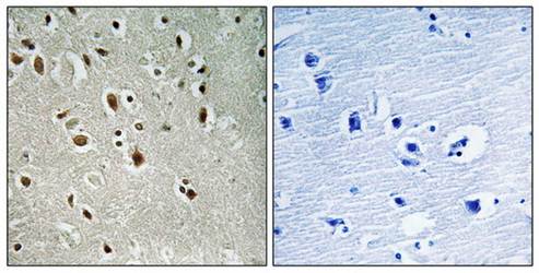 ANKRD20A3 Antibody