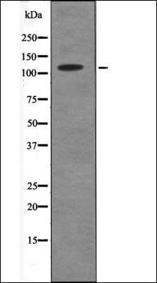 ANKRD28 (Phospho-Ser1040) antibody