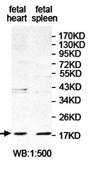 ANKRD39 antibody