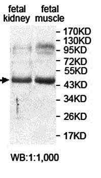 ANKRD40 antibody