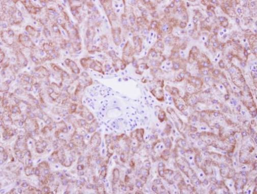 ANKRD45 Rabbit Polyclonal Antibody
