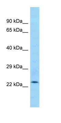 Ankrd46 antibody