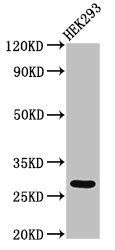 ANKRD49 antibody
