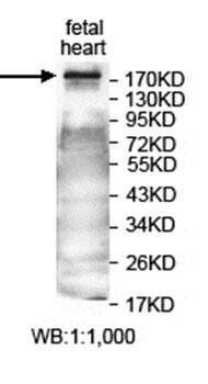 ANKRD50 Rabbit Polyclonal Antibody