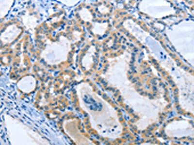 ANKRD54 antibody