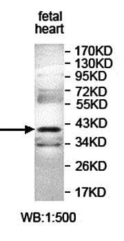 ANKRD54 Rabbit Polyclonal Antibody