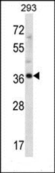 ANKRD60 antibody