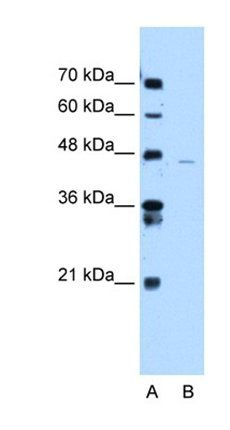 ANKRD65 antibody