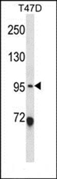 ANKS6 antibody