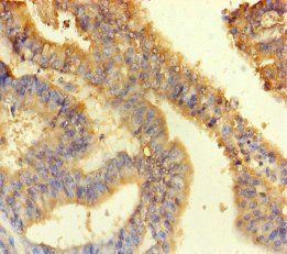 ANKS6 Antibody