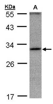 ankyrin repeat domain 45 antibody