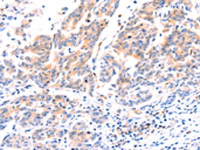 ANKZF1 Antibody