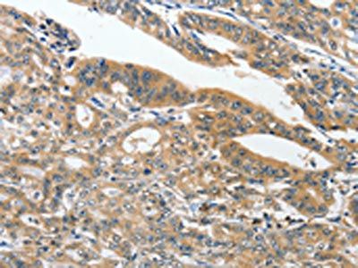 ANKZF1 Antibody