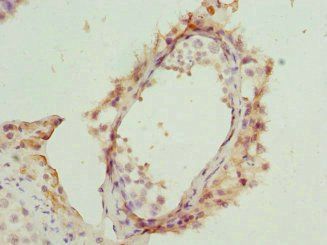 ANLN Antibody