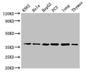 Annexin A1 antibody (Biotin)