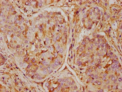 ANXA5 Antibody