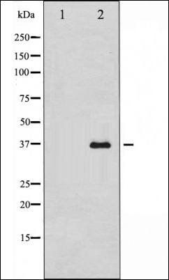Annexin II antibody
