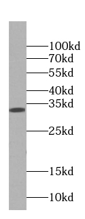 Annexin IV antibody