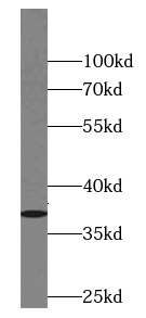 Annexin VIII antibody