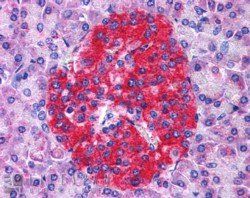 Goat anti-Annexin A10 / Annexin 14 Antibody