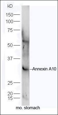 Annexin A10 antibody