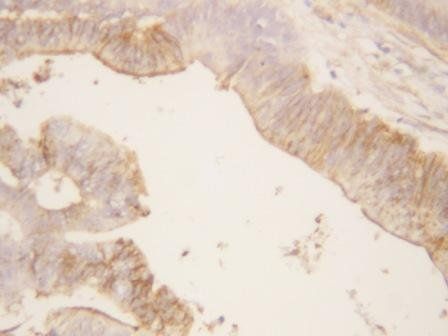 Anti-Annexin A2/ANXA2 Antibody