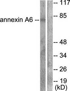 Annexin A6 antibody