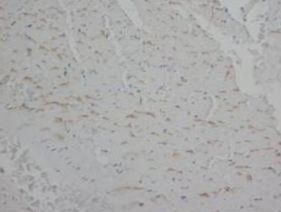 Anti-Annexin V/ANXA5 Antibody