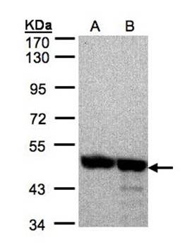 Annexin VII antibody